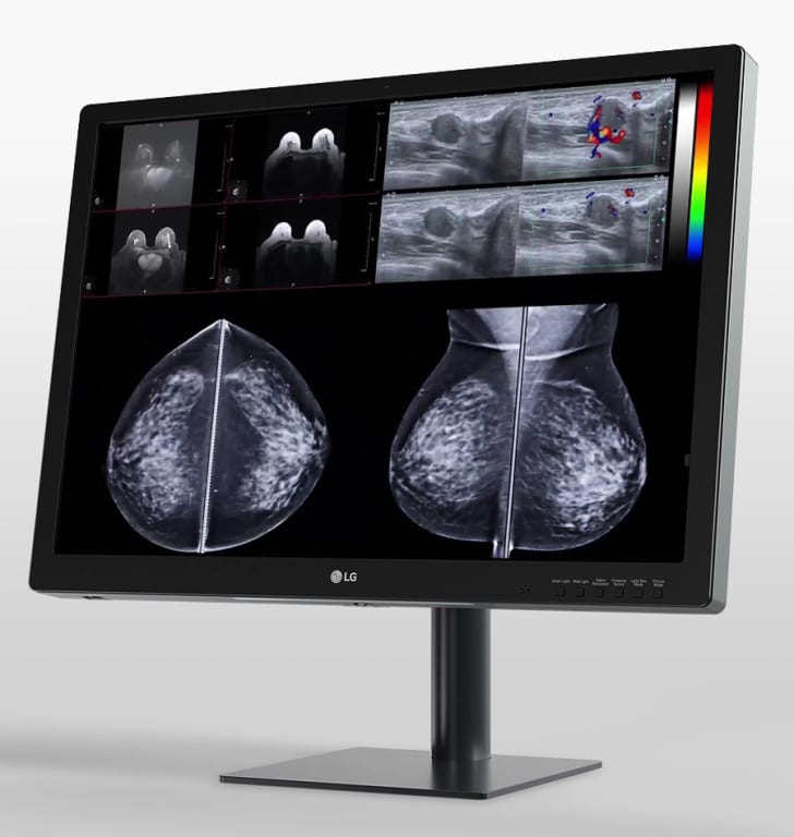 LG 31'' 12MP 4200 x 2800 IPS Diagnostic Monitor for Mammography l 31HN713D  l LG GLOBAL