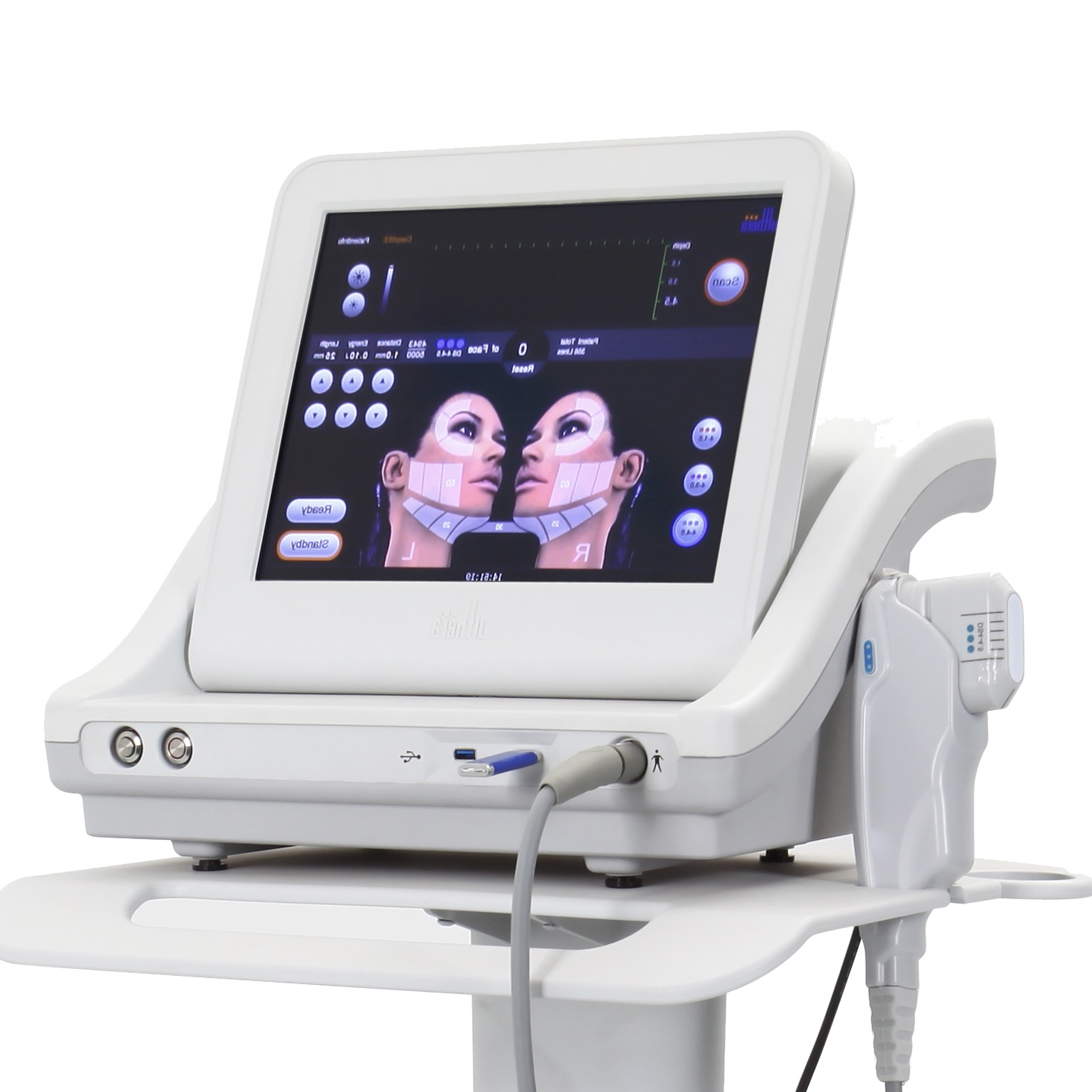 HIFU focused ultrasound device at SAS Clinic