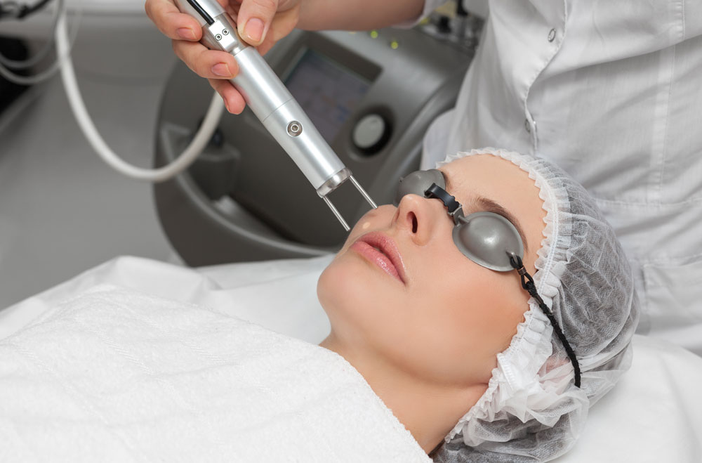 Pico Laser treatment for pigmentation with protective eyewear