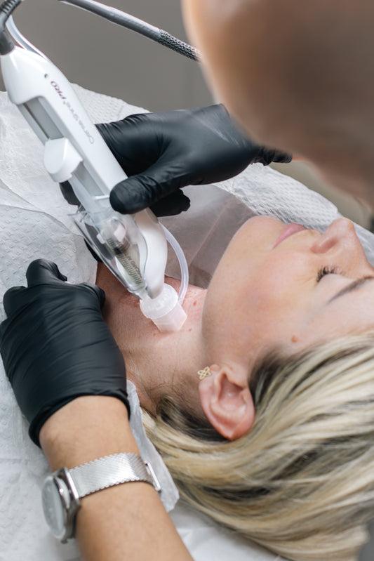 DERMASHINE PRO treatment
