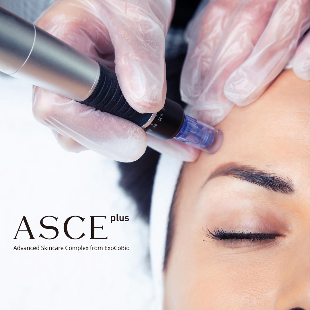 ASCE+ treatment products