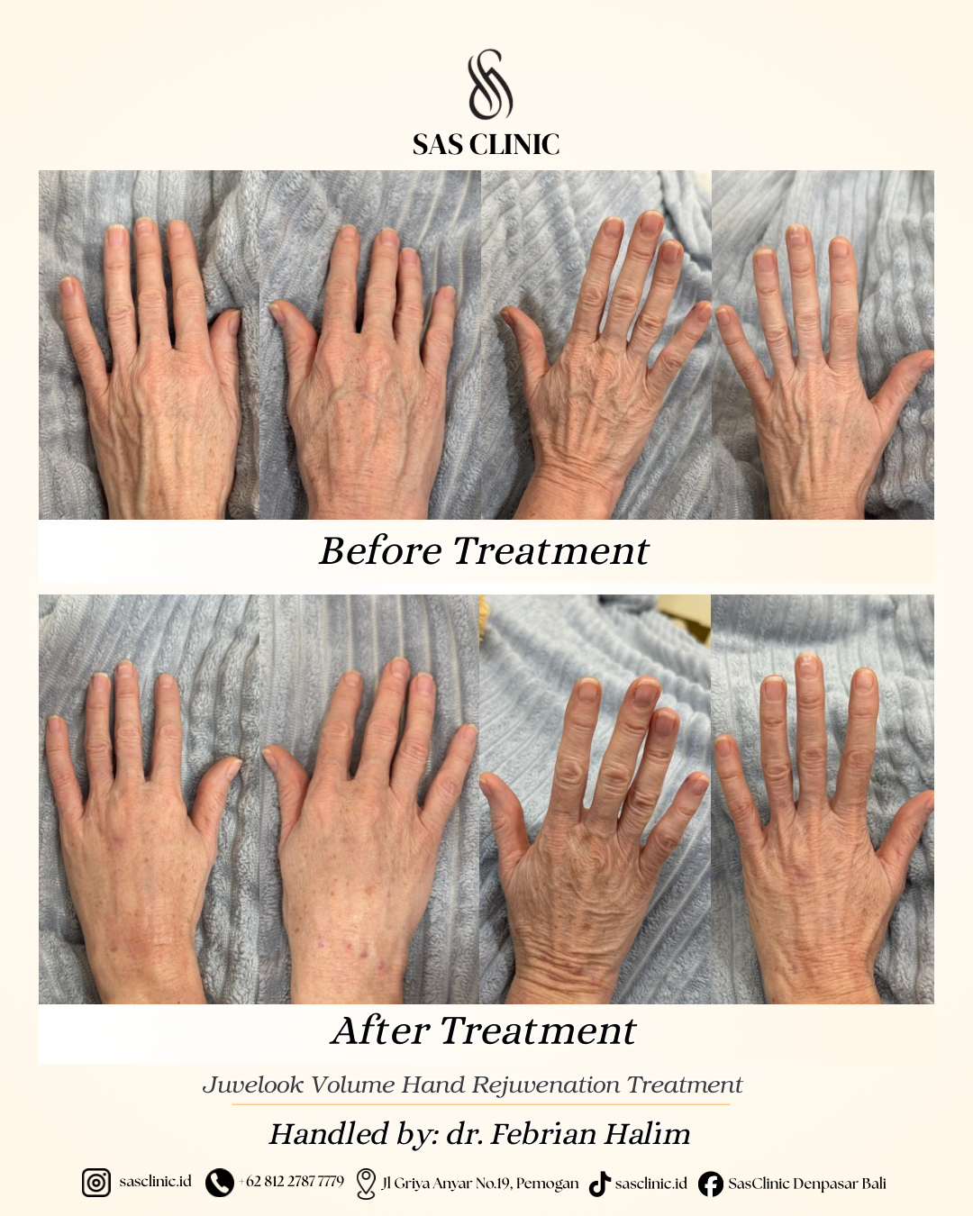 Before and after photos at SAS Clinic Bali