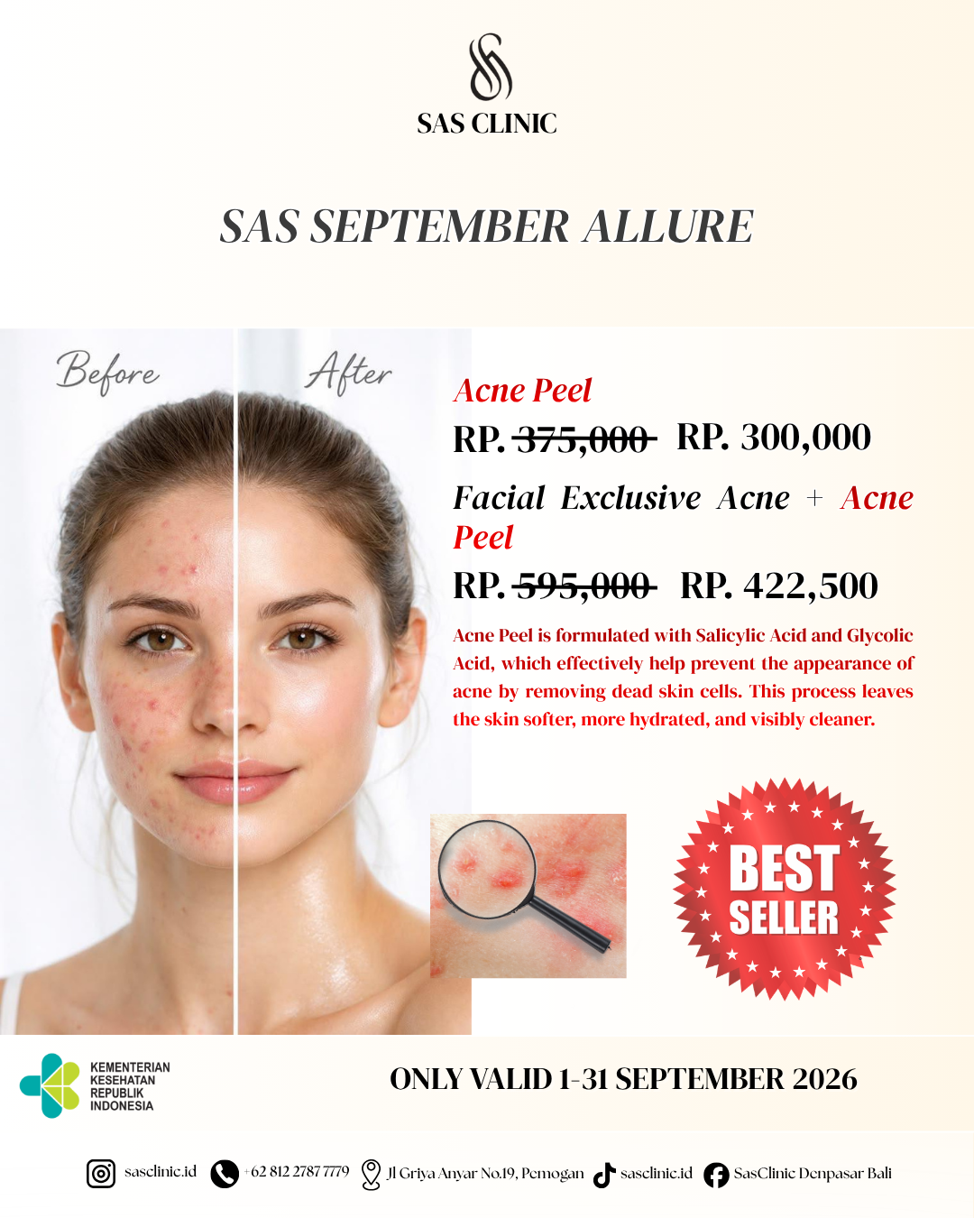 Peeling Treatment - september promo 4 of 6