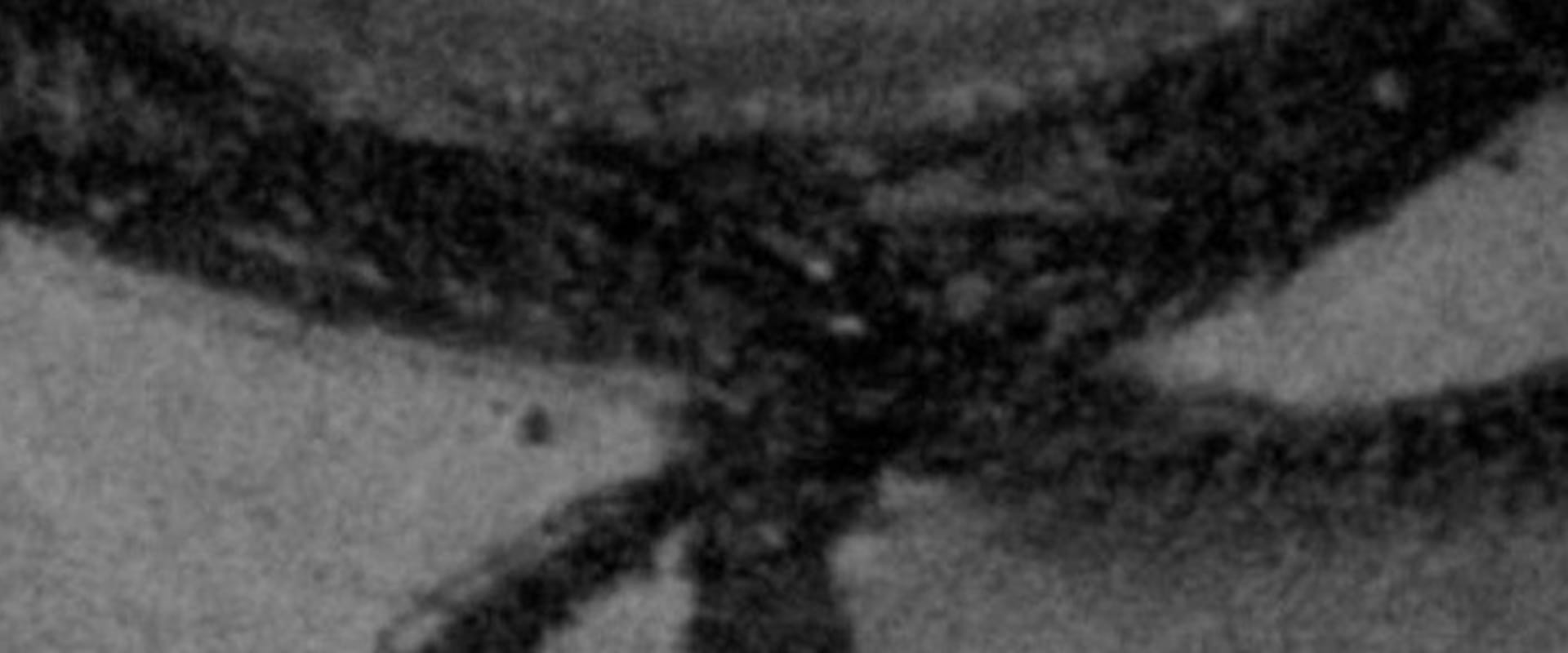 Documentary backdrop image for The Eyeball Person (2023)