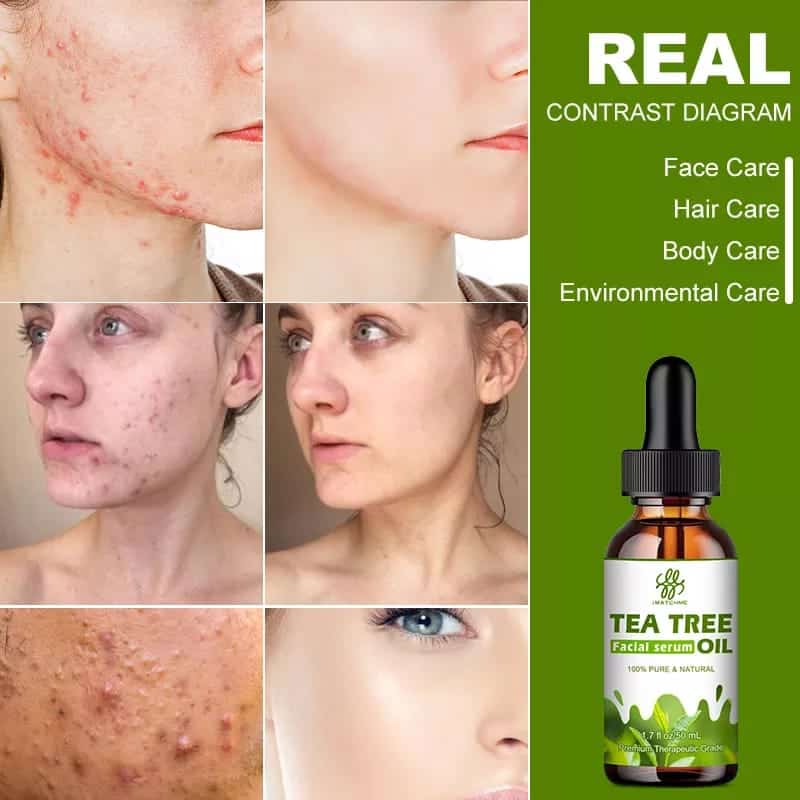 Tea Tree Oil Face Serum