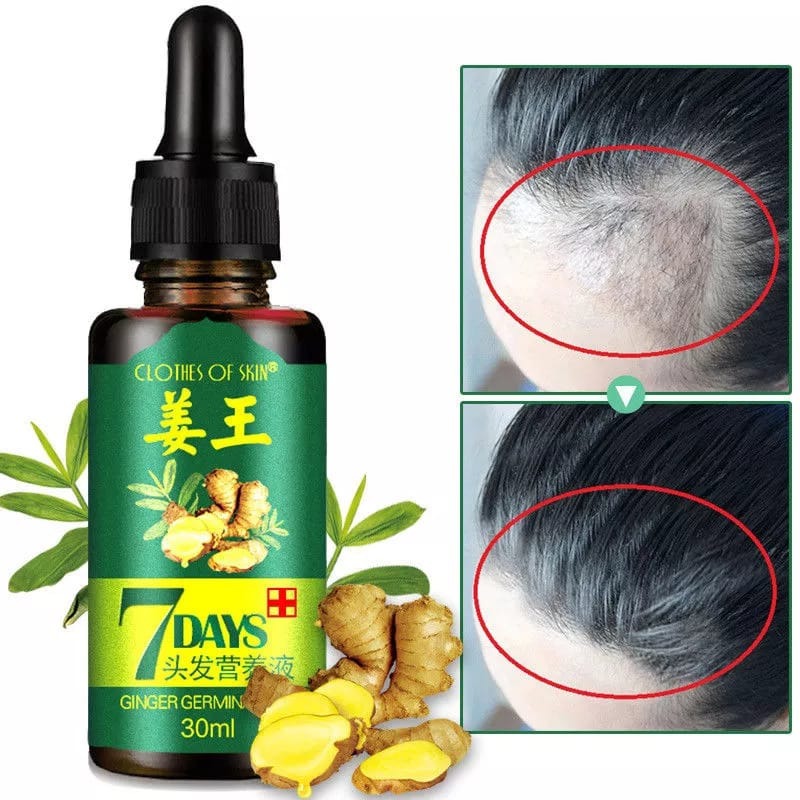 Hair Loss Treatment Hair Oil Care
