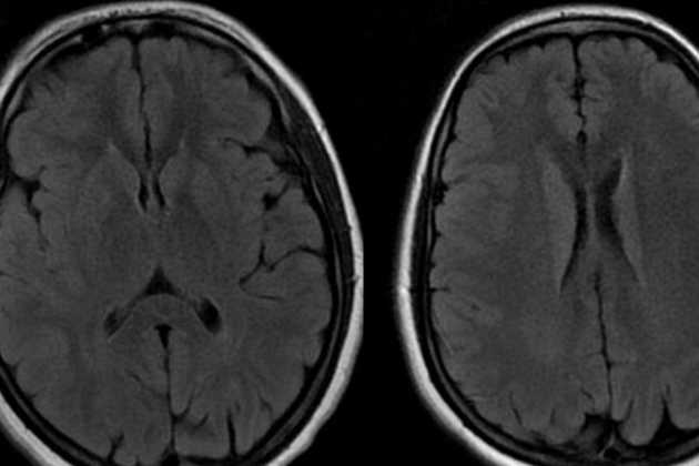 Children brain MRI Children brain MRI