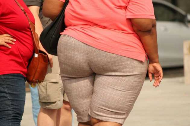 Obese people Obese people