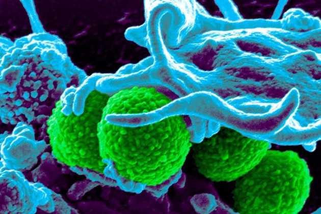 superbugs superbugs