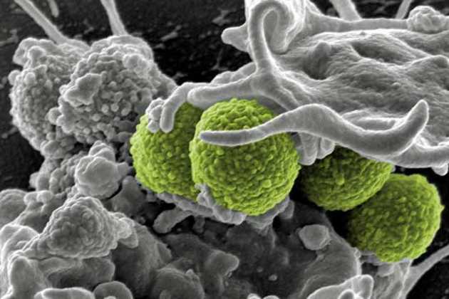 Deadly bacteria Deadly bacteria