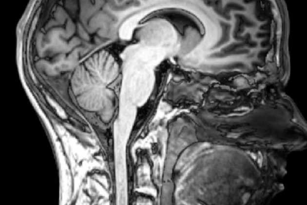 Brain scan Brain scan
