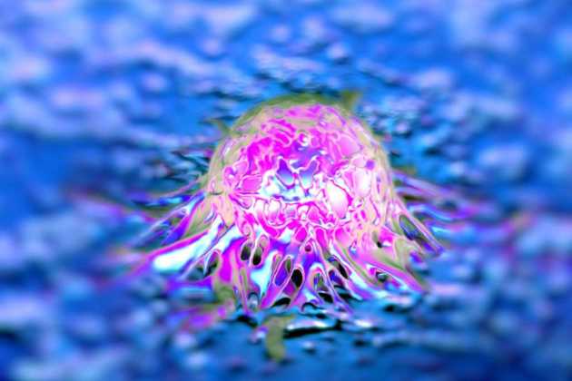 Cancer cells Cancer cells