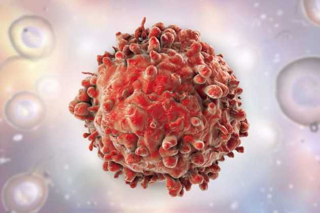 Cancer cells Cancer cells