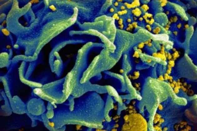 Novel antibody may suppress HIV for up to four months Novel antibody may suppress HIV for up to four months