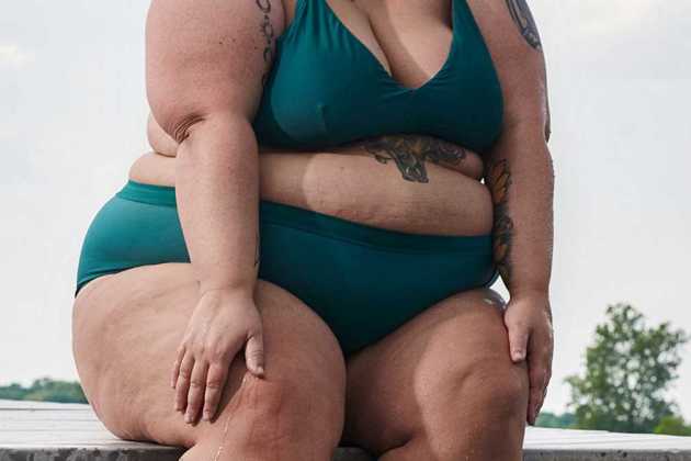 Obese people Obese people