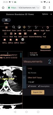 measurements