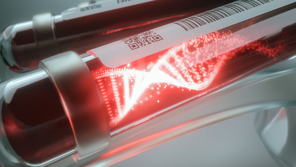 Blood Test Can Classify Small-Cell Lung Cancer Subtypes Blood Test Can Classify Small-Cell Lung Cancer Subtypes - blood test