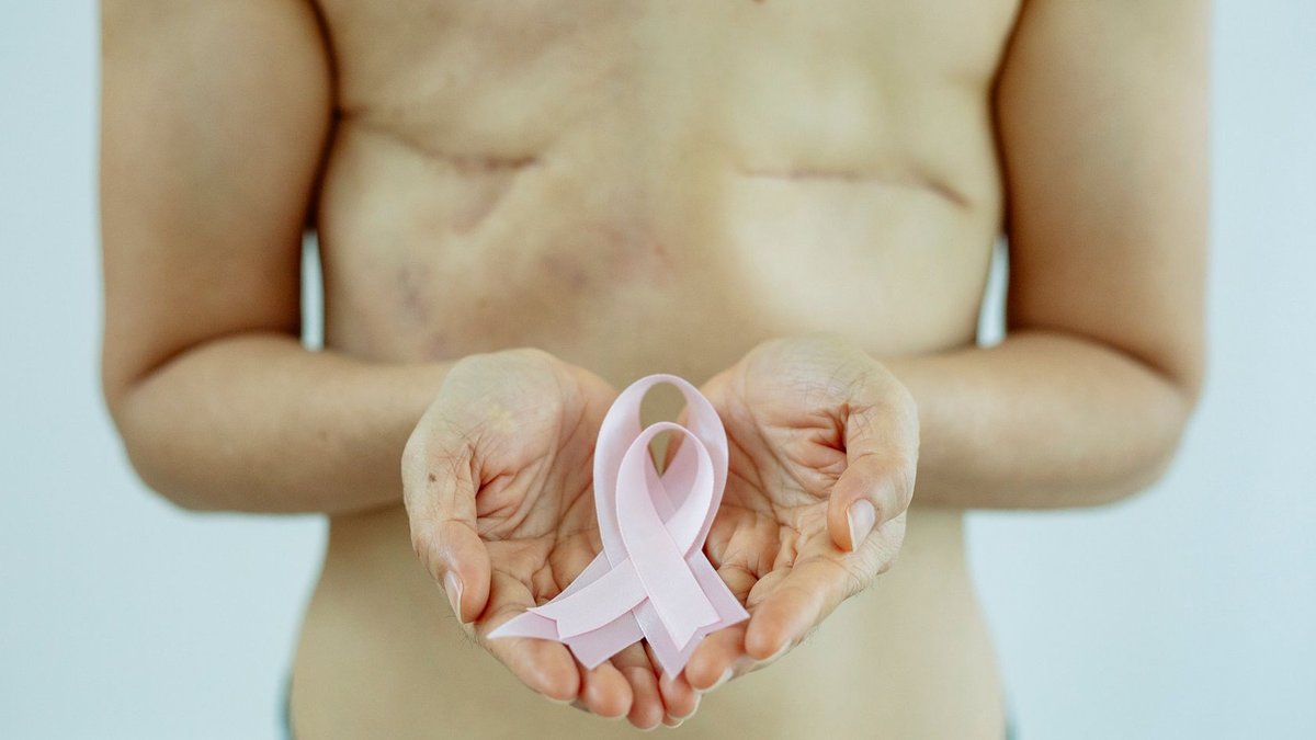 Medical debt linked to late stage cancers Medical debt linked to late stage cancers - medical debt
