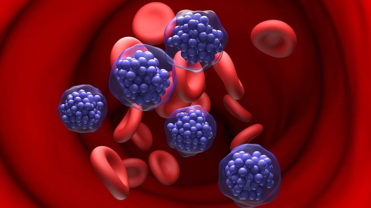 Pola-R-GemOx Improves Survival in DLBCL Patients - pola-r-gemox treatment