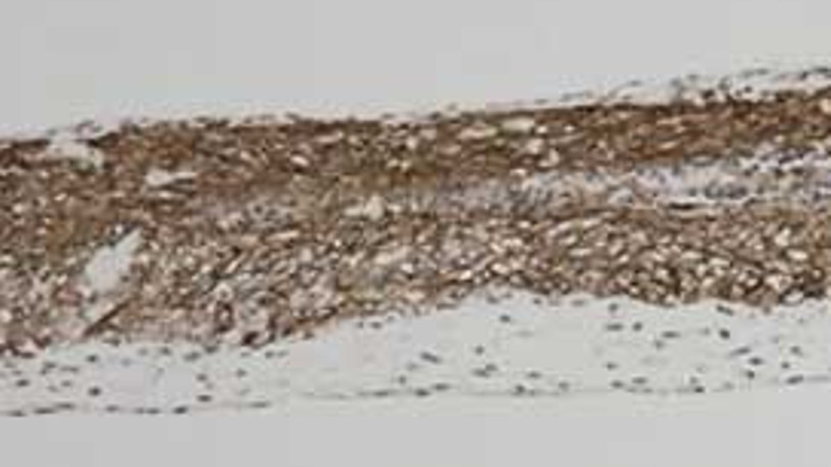Mitsui Chemicals Launches New Device to Improve 3D Organoid Drug Mitsui Chemicals Launches New Device to Improve 3D Organoid Drug - 3d organoid device