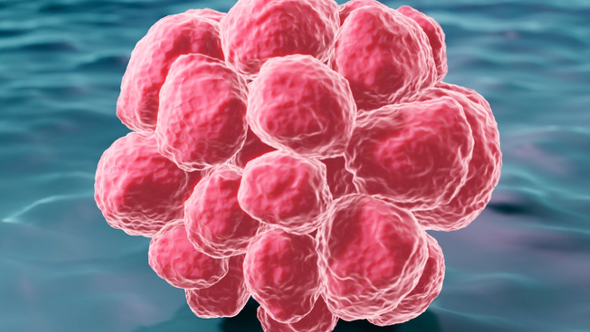 Mechanical pressure kills invasive cancer cells Mechanical pressure kills invasive cancer cells - cancer cells