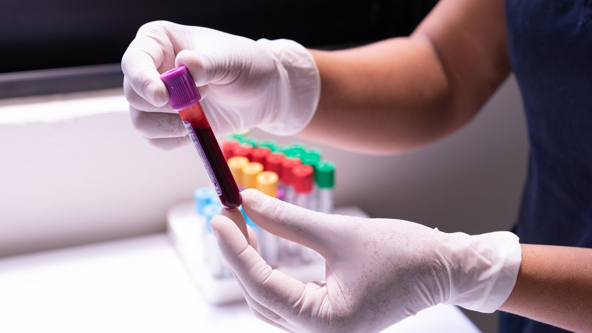 Nigeria launches global partnership to tackle sickle cell disease Gloved hands carefully handling a blood sample in a medical or laboratory environment.
