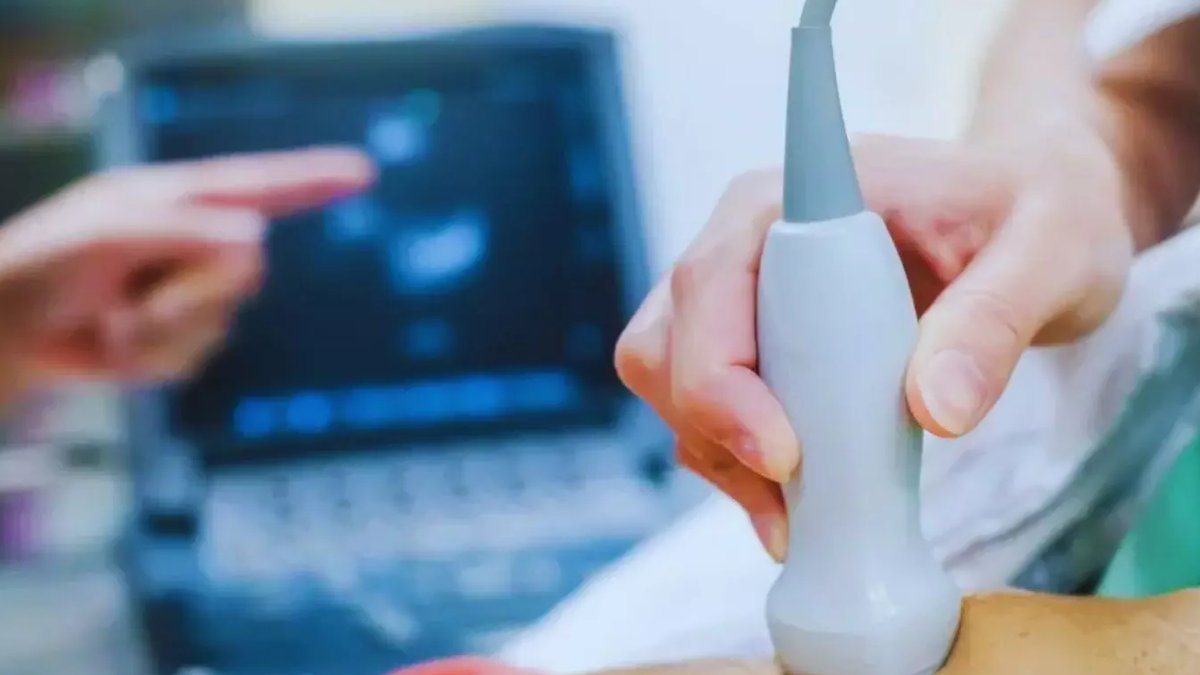 Ultrasound Predicts ICU Muscle Weakness Within Days of Admission
