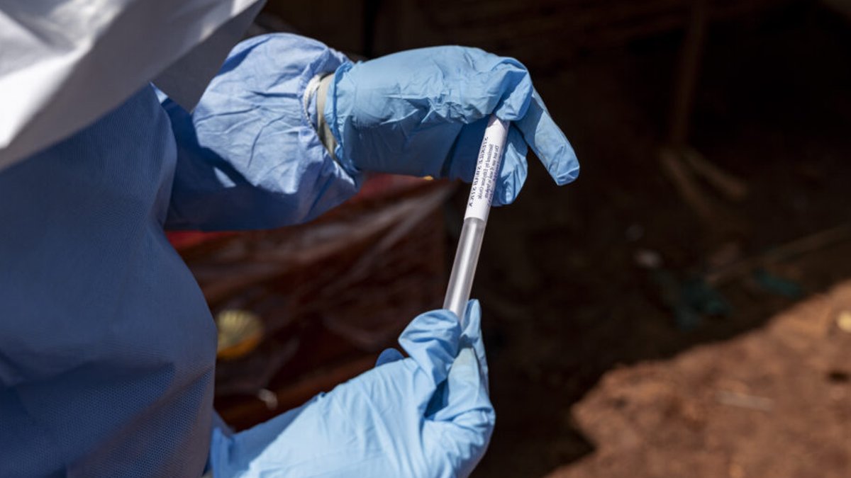 Nigeria Confirms Imported Ebola Case from Uganda - imported ebola case