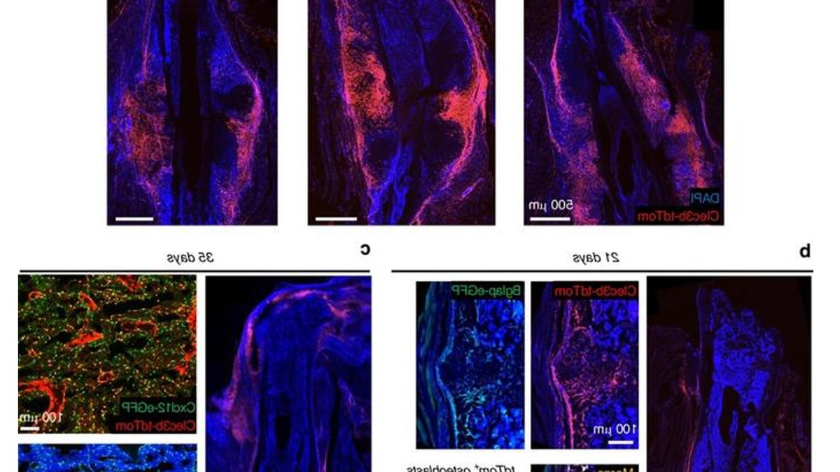 Muscle cells found to play key role in bone healing Muscle cells found to play key role in bone healing - muscle cells bone healing