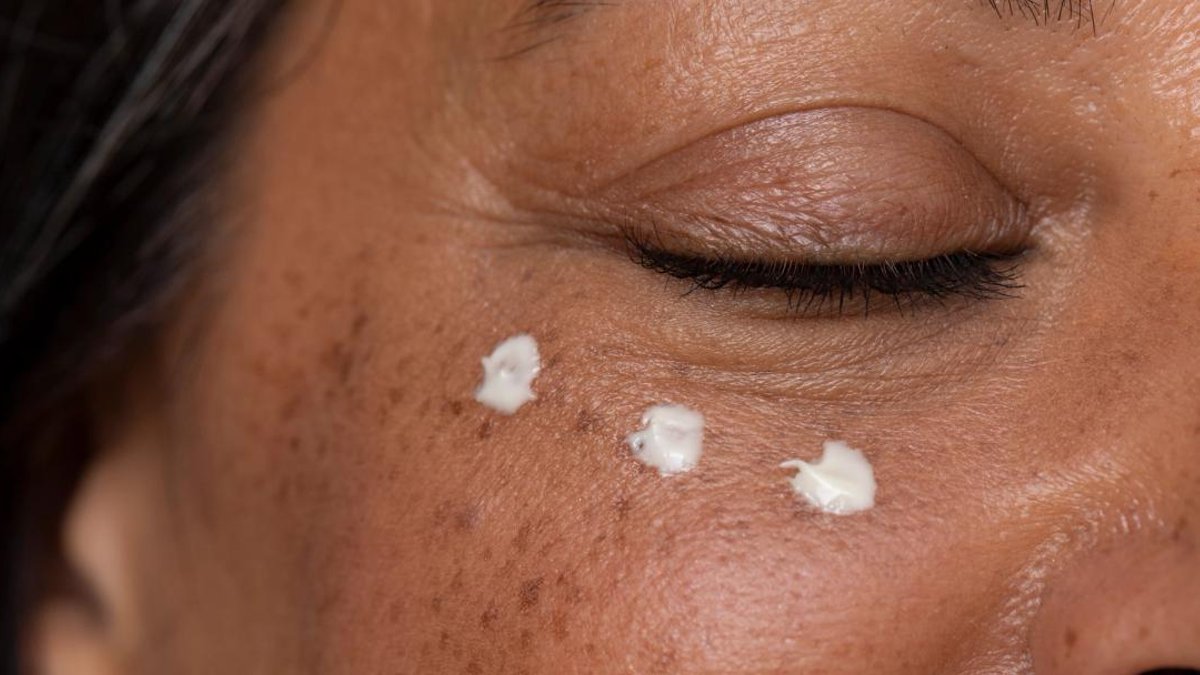Alastin’s Eye Cream Targets Crepey Upper Eyelids with Promising Results - eye cream