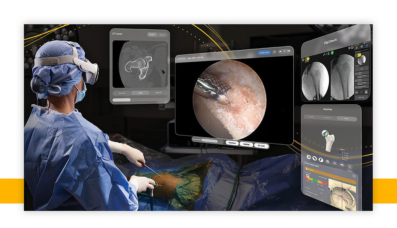 A gowned surgeon wearing a mixed reality headset operates on a draped patient while virtual panels showing a CT scan, live arthroscopic video, HipCheck X-ray measurements and a colour-mapped 3D femur model float around the operating table.