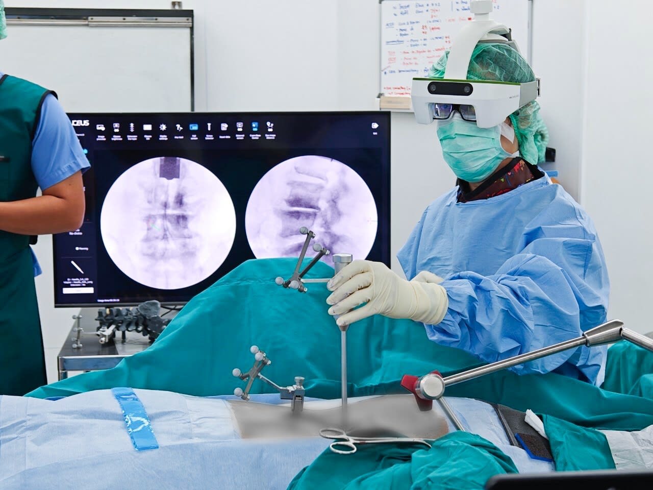 A surgeon in scrubs wearing a head-strapped transparent augmented reality visor operates on a draped patient, with optical tracker arrays on the patient and instruments and a navigation screen showing spinal X-rays behind.