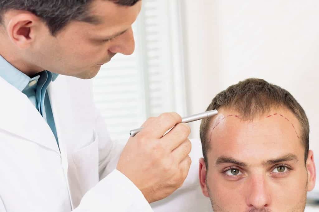 The Best Hair Loss Treatments for Men and Women  GoodRx