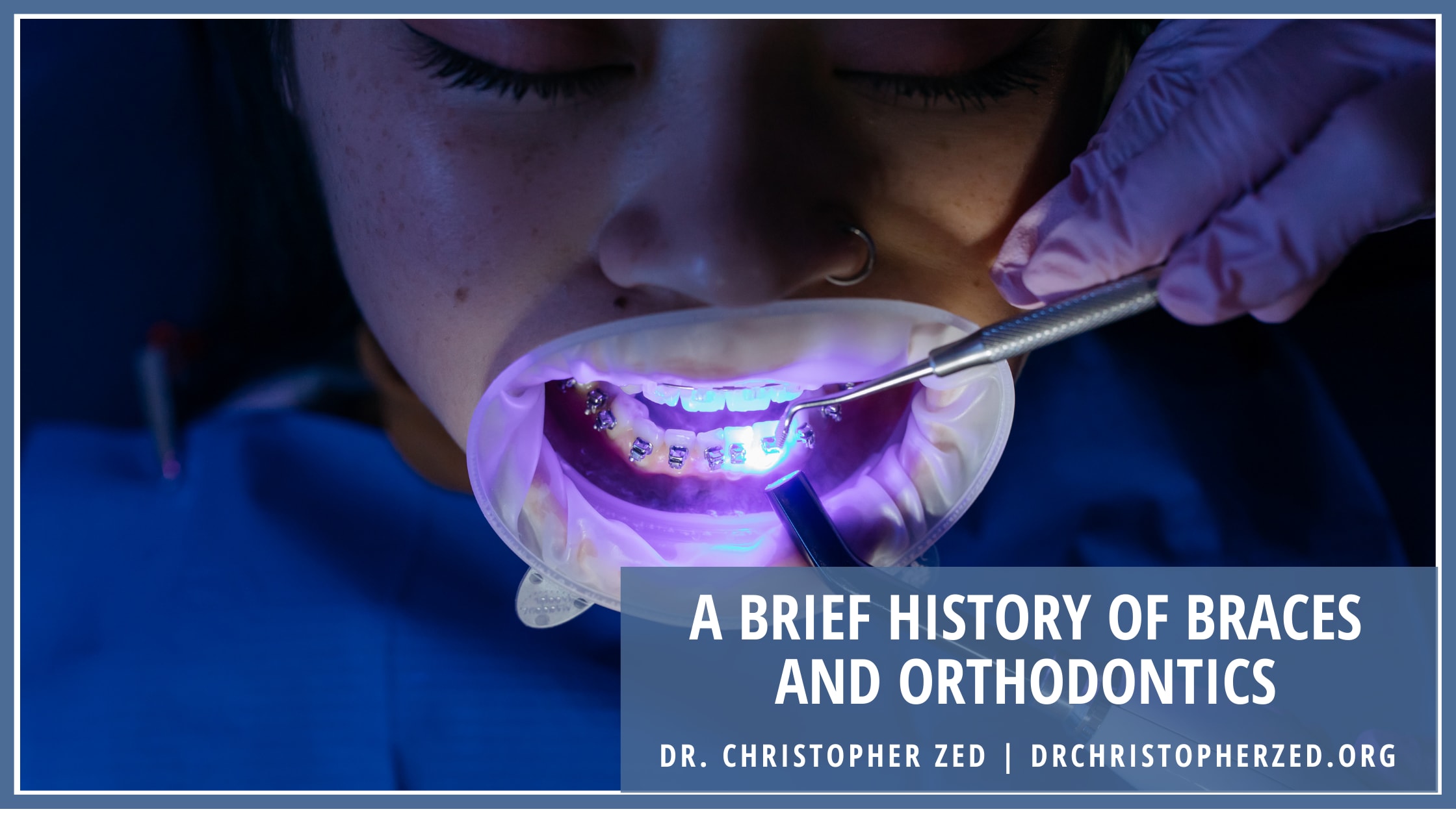A Brief History of Braces and Orthodontics FYI