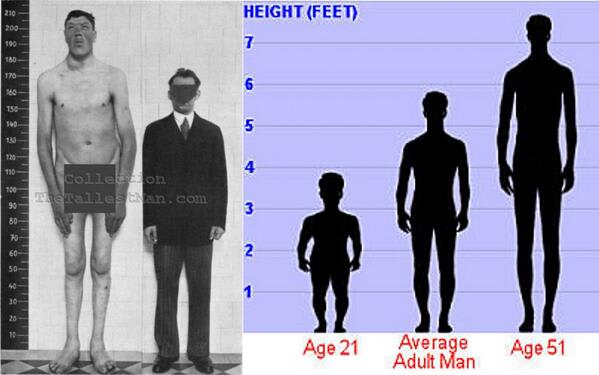 The Life Of Adam Rainer From Dwarfism To Gigantism | Humans