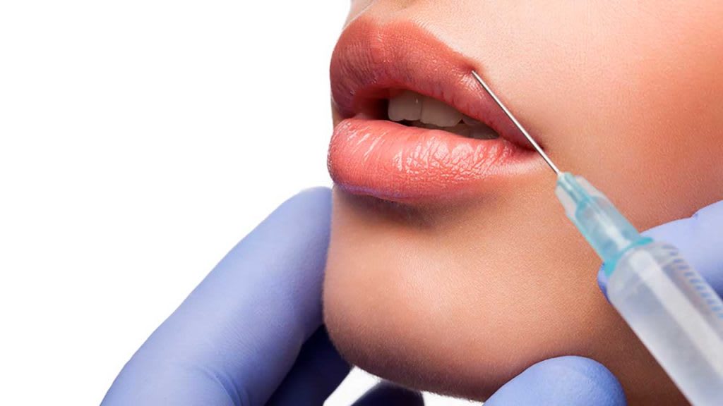 Lip Fillers in Nottingham: What to Expect Before and After | Journal