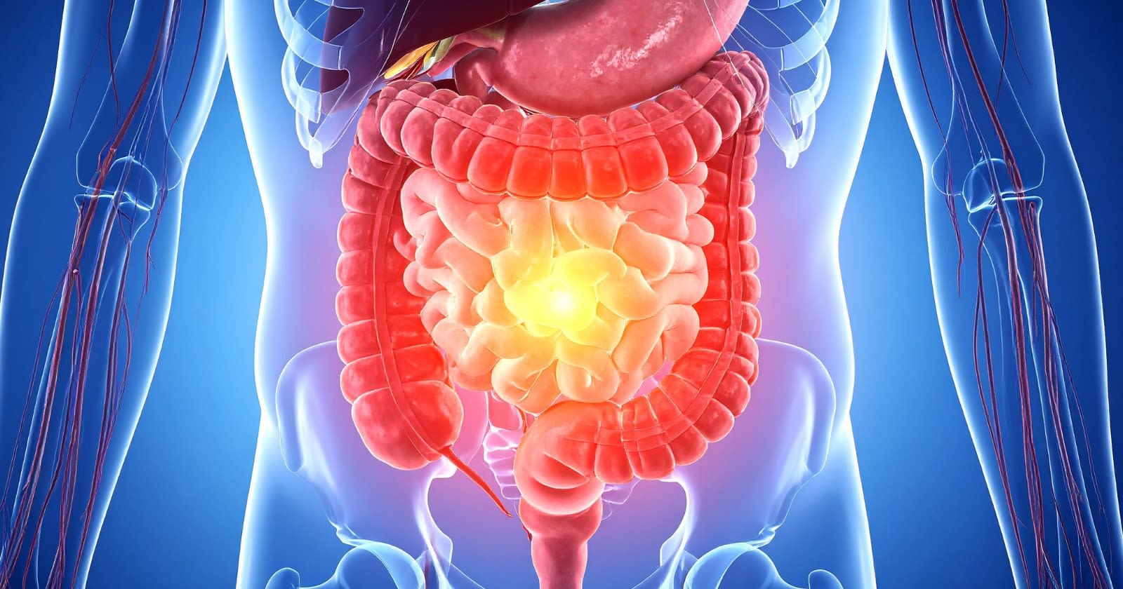 Global Colon Screening Market Forecast to Reach USD 23.51 Billion by 2033 Global Colon Screening Market Forecast to Reach USD 23.51 Billion by 2033