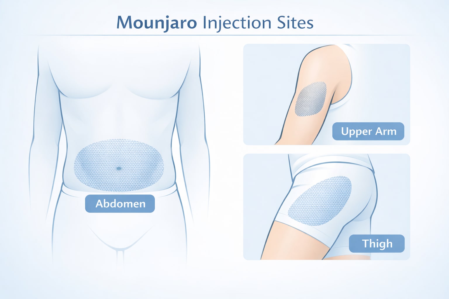 why is my tirzepatide clear Tirzepatide Injection Rotation Map