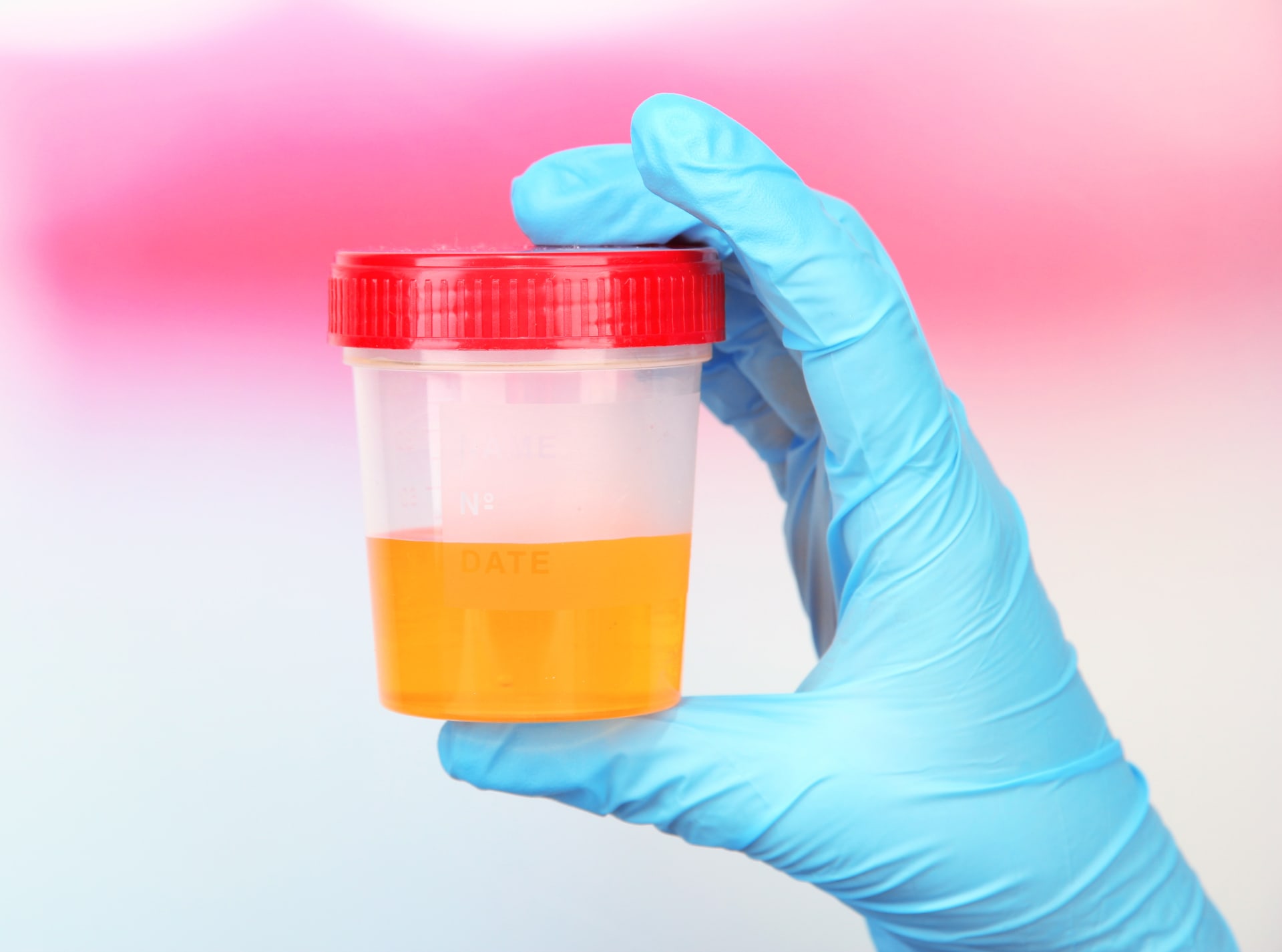 presentation of urine test