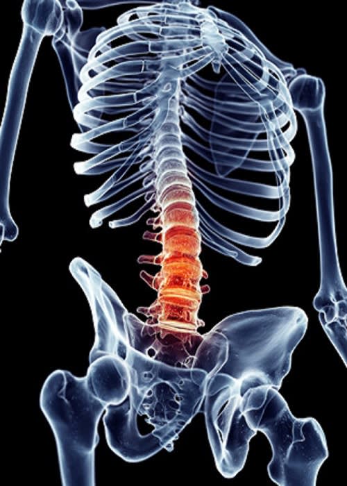 pathological fracture due to osteoporosis icd 10