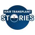 Hair Transplant Stories