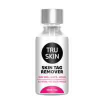 TruSkin Skin Tag Remover Customer Review