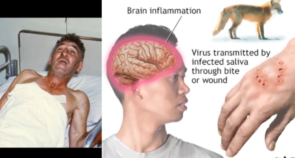 Why People Infected With Rabies 'Bark' Like Dogs Petlife