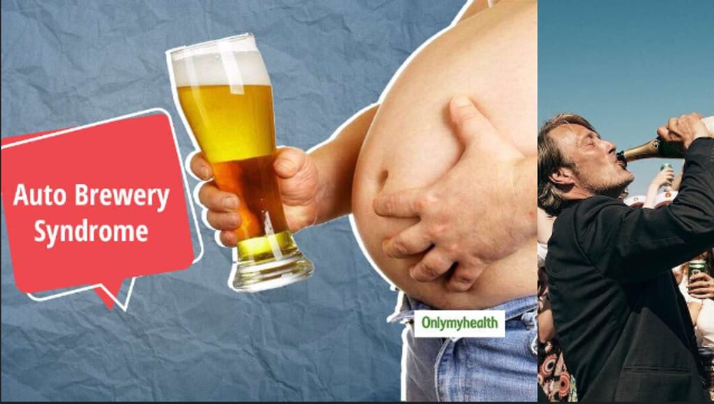 AutoBrewery Syndrome When Your Body Betrays You and Makes You Drunk