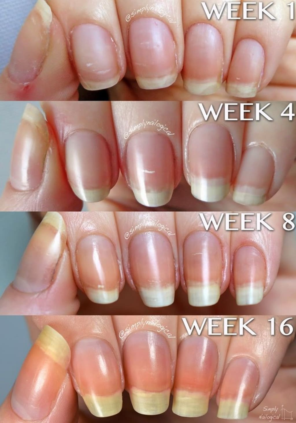 Flaunt Strong and Resilient Nails: Tips for Achieving Unbreakable Nail  Growth