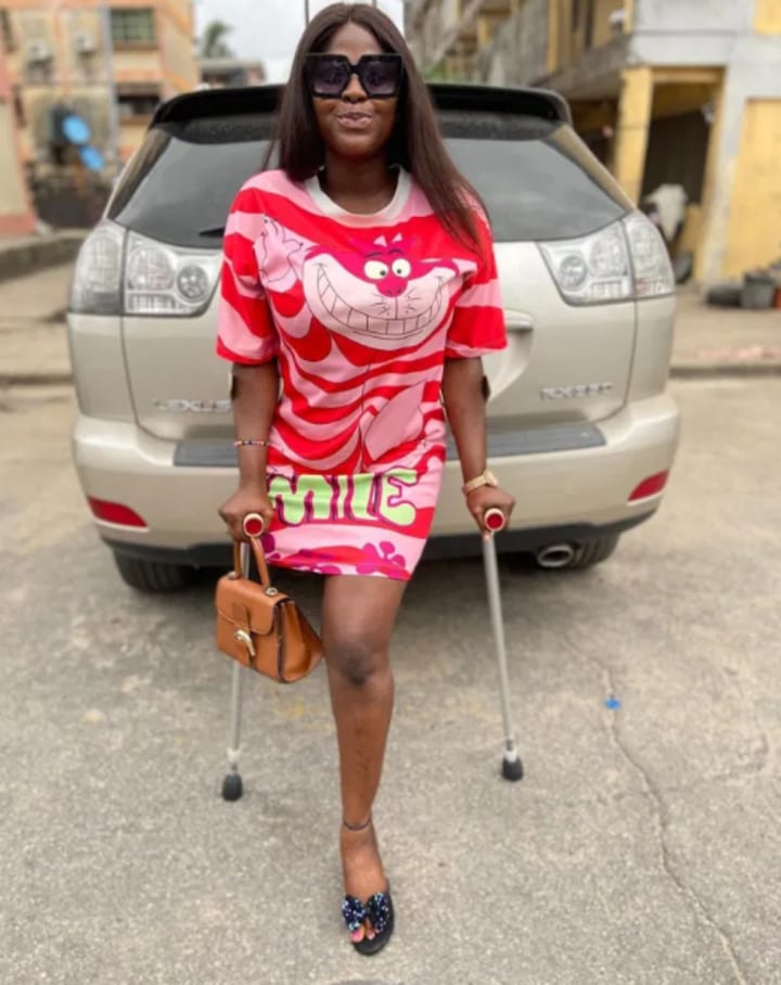 Why Men Fall In Love With Me Despite Losing A Leg - Actress, Doris Akonanya