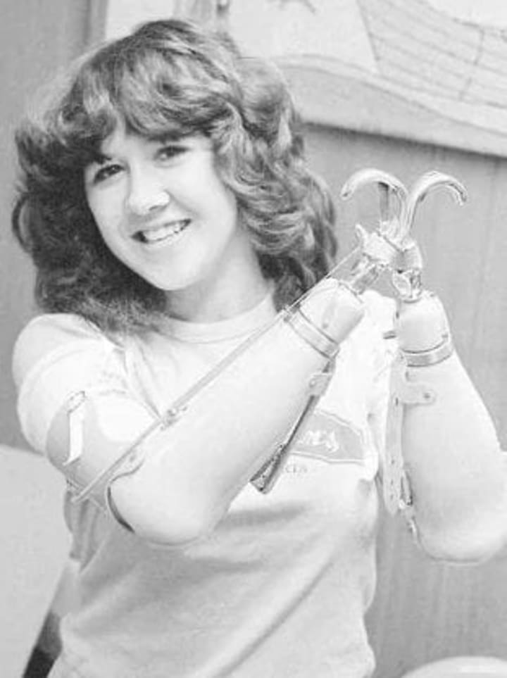 Chopping Off Her Arms Didn't Stop Her Criminal