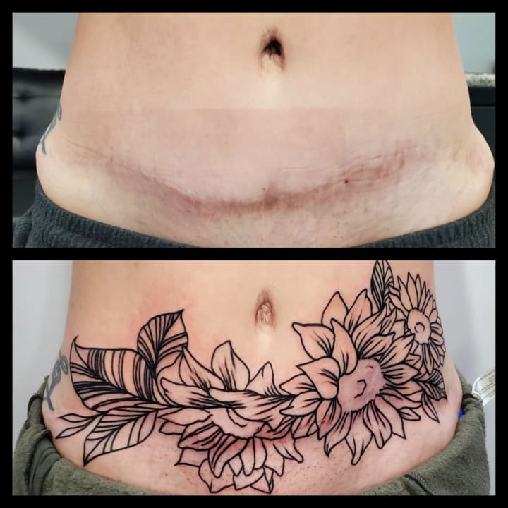 Covered my tummy tuck scar Artist Heather MenteerOak Street Tattoo  Lathrop MO  rtattoos