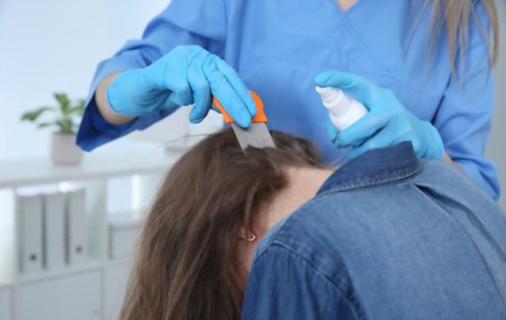 How Lice Doctor Helps in Removing Lice from Your Hair? Lifehack