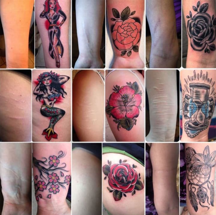 How Paramedical Tattoo Artists Turn Traumatic Scars Into Healing Art